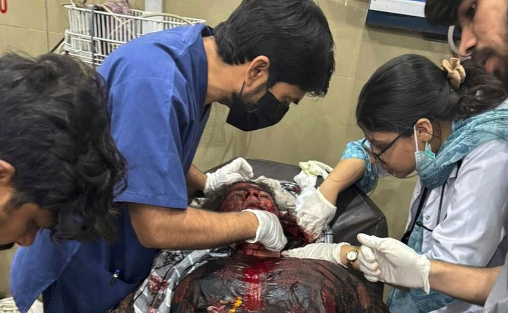 En esta fotografía publicada por Inter Services Public Relations, se muestra a médicos en Paquistán apoyando a heridos en un hospital de Bahawalpur. (06/04/25) Foto: Inter Services Public Relations via AP