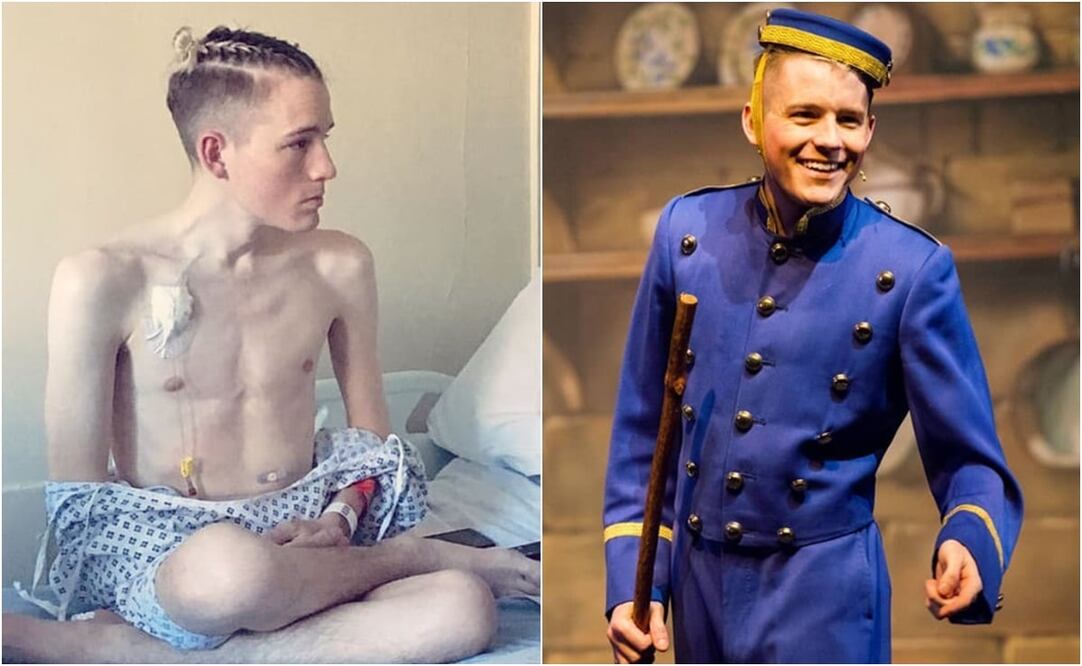 Charles Michael Duke, antes y después del trasplante. Foto: Instagram de Charles Michael Duke