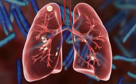 Descubren el mecanismo que hace a la tuberculosis tan virulenta