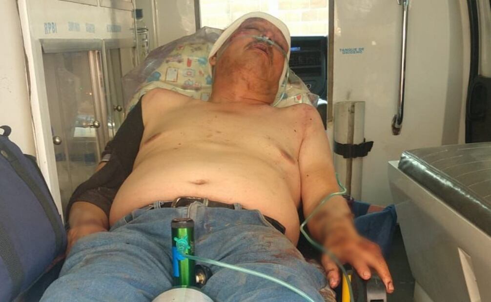 Hubo personas con fuertes lesiones (12/03/2025). Foto: Especial