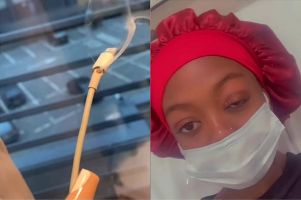 Una de las chispas alcanzó a tocar el ojo de la joven, dejándola parcialmente ciega / Foto: Captura de pantalla