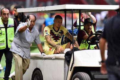 Nico Castillo sufre fractura de peroné