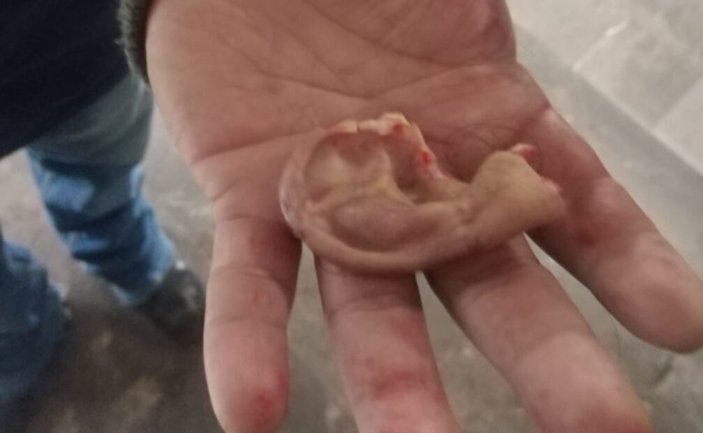 Como Mike Tyson: sujeto le arranca la oreja a un usuario en el Metro Xola