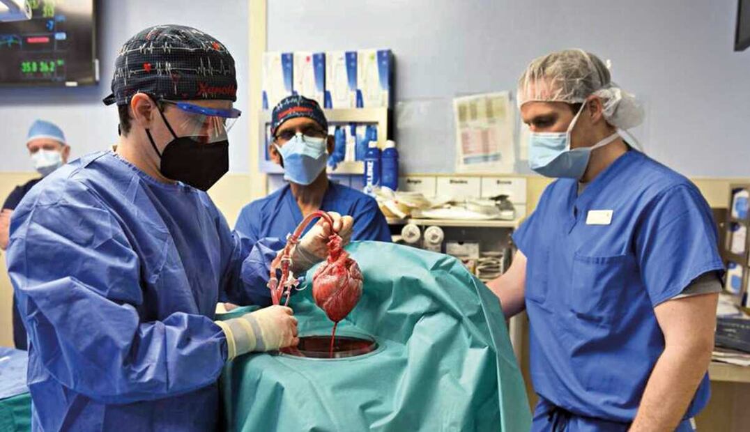 La donación de órganos es una labor altruista. Foto: Archivo EL UNIVERSAL