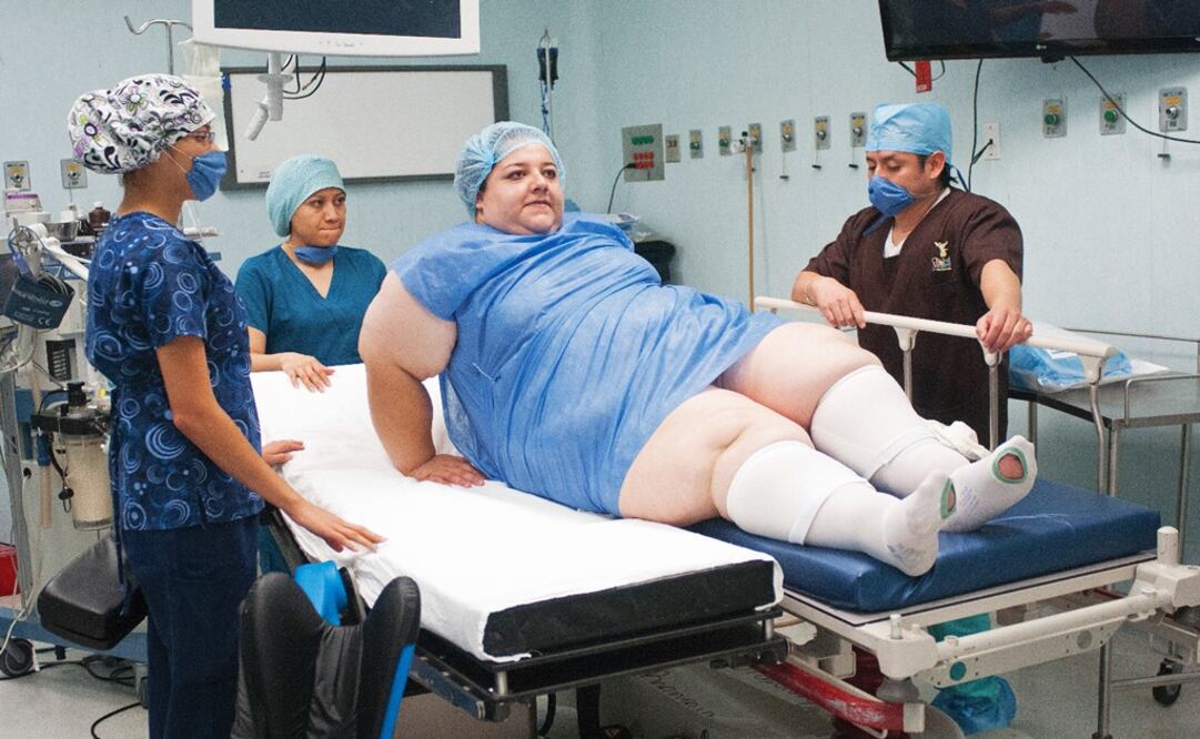 Mexico is the country with the largest number of obese people worldwide - Photo: File Photo/EL UNIVERSAL
