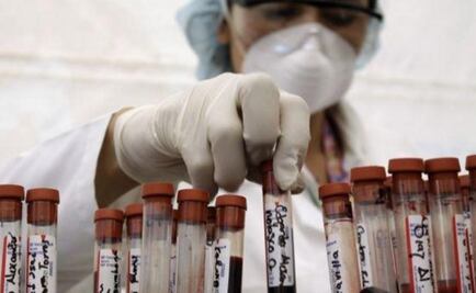 Los hombres están más en riesgo de morir de sida que las mujeres