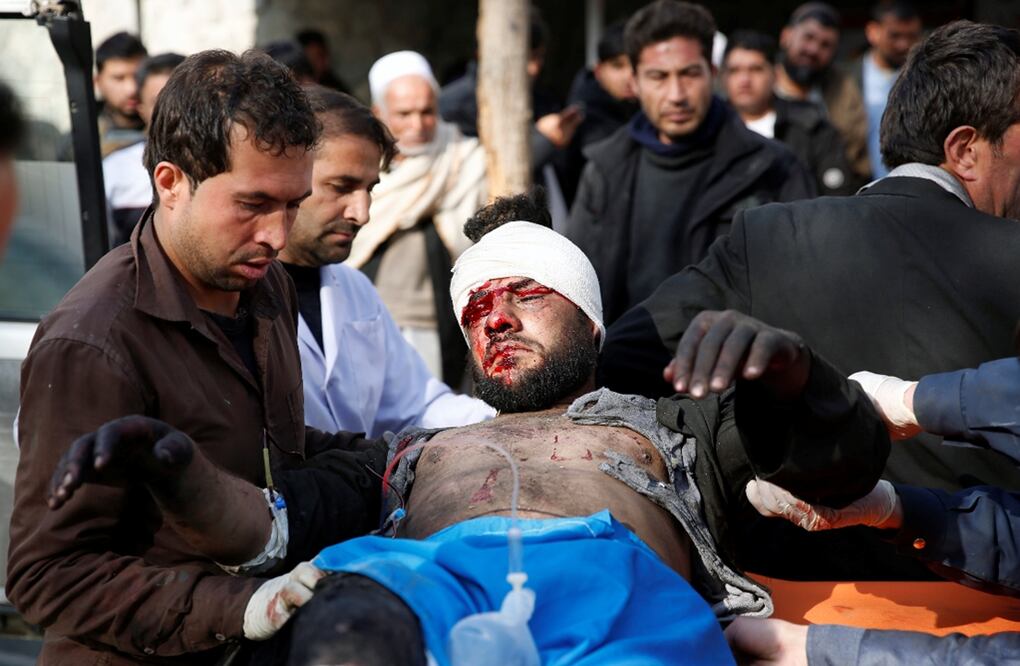 Kabul, Afganistán
La explosión de una ambulancia bomba en Kabul causó casi 100 muertos y 158 heridos, sembrando pánico y terror en un barrio muy concurrido de la capital afgana. Foto Reuters