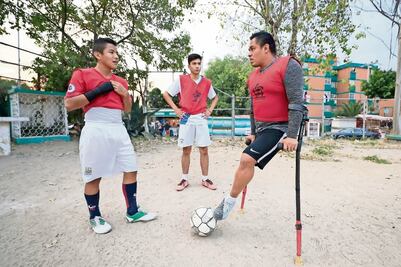 “Tengo que aceptarme como soy”; la historia del segundo niño del Teletón