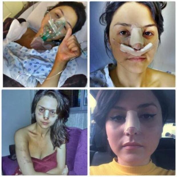 Joven modelo denuncia brutal golpiza por parte de guitarrista