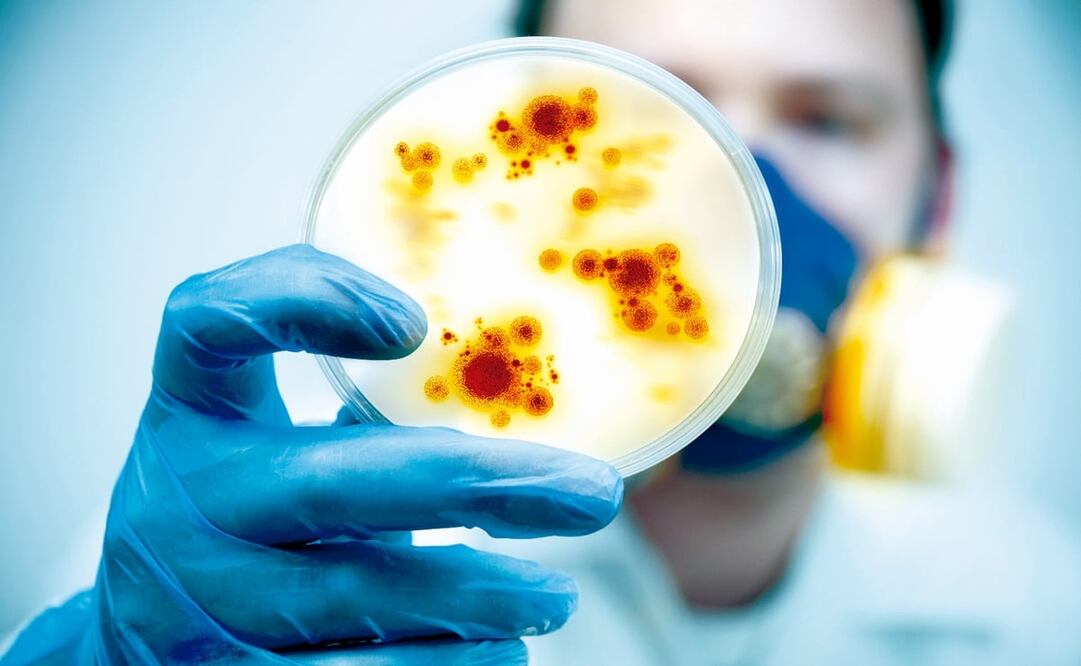 La brucelosis es una enfermedad bacteriana, infecto-contagiosa, que afecta a varias especies de mamíferos - Foto: Archivo