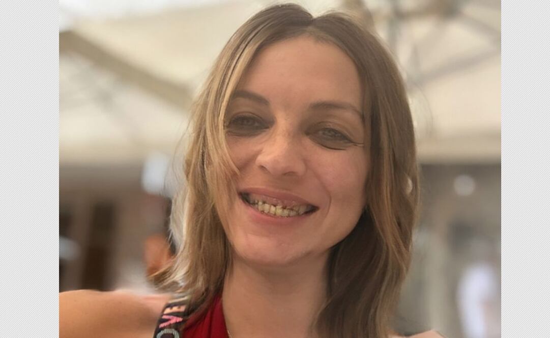 Camilo Blanes presume su sonrisa y la ausencia de dientes.