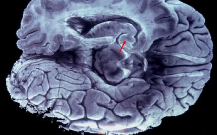 Científicos identifican las neuronas que controlan la estimación del tiempo