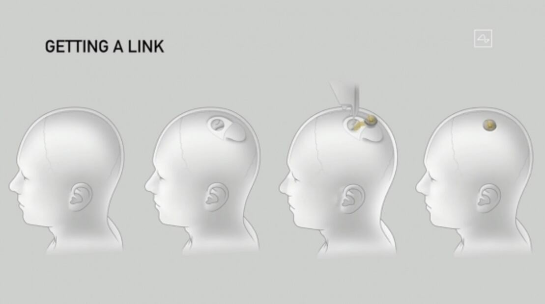 Elon Musk presenta a los primeros cerdos con Neuralinks implantados en sus cerebros