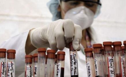 Vacuna contra el VIH logra controlar virus sin necesidad de fármacos