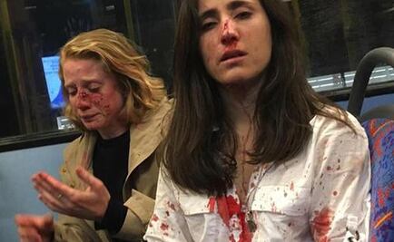 Foto de ataque a pareja de lesbianas impacta en Inglaterra y da la vuelta al mundo