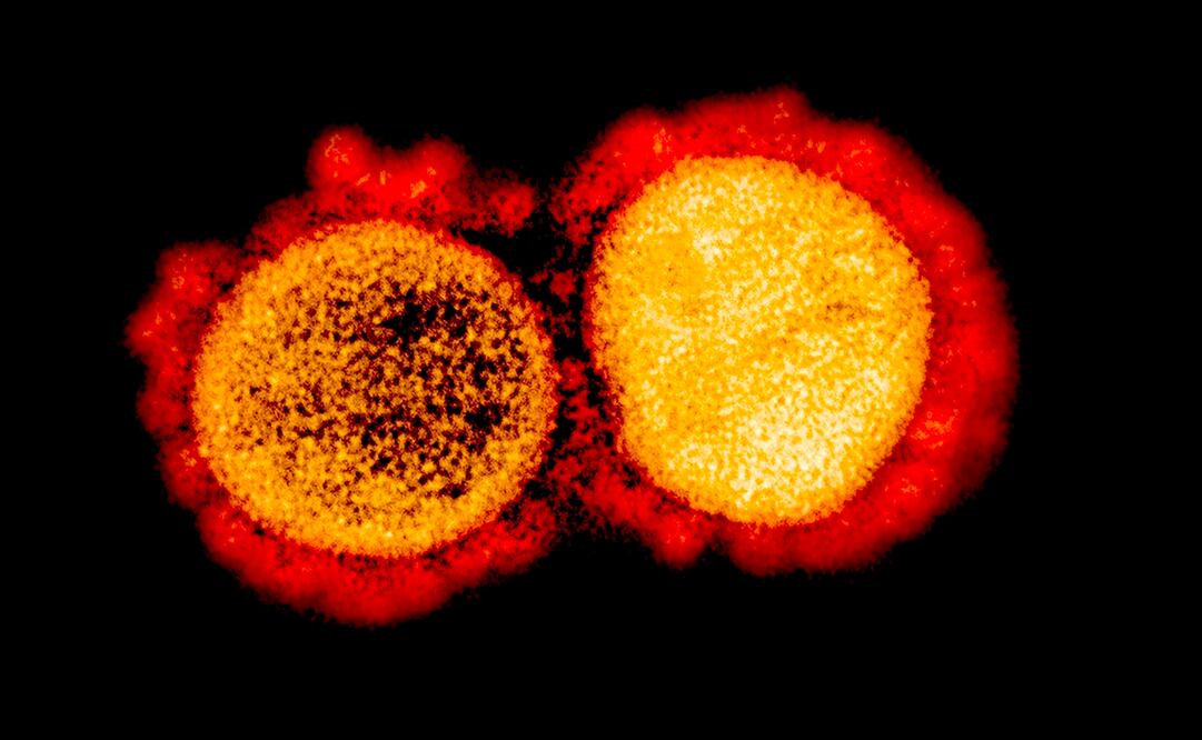Imagen en la que se aprecia a través de una micrografía electrónica de la transmisión de partículas del coronavirus SARS-CoV-2. Foto: Handout / National Institute of Allergy and Infectious Diseases / AFP