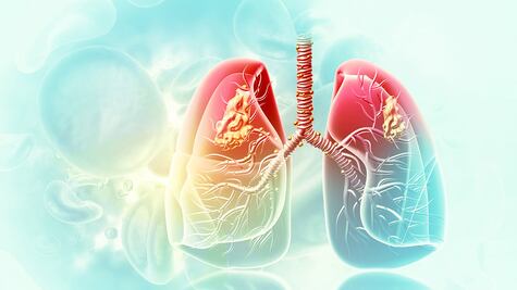 Un paso adelante del cáncer