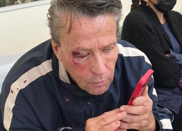 "Le van a meter un tiro"; Adame amenaza a periodista que reveló video de pelea