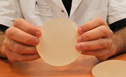 "Botched": el reto contra la adicción a las cirugías plásticas