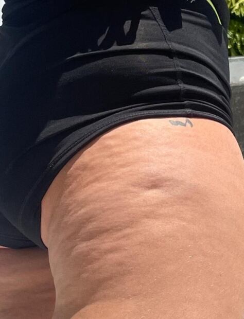 Lele Pons ya no oculta su celulitis y la muestra en fotos