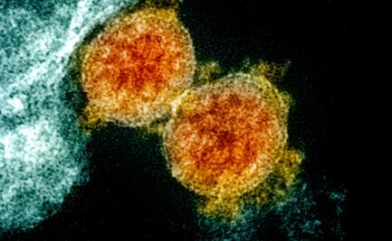 Descubren molécula capaz de destruir genoma del coronavirus