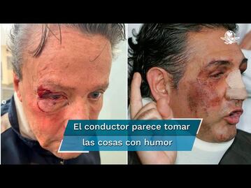 "A Fabiruchis le pegaron más": Alfredo Adame tras cirugía