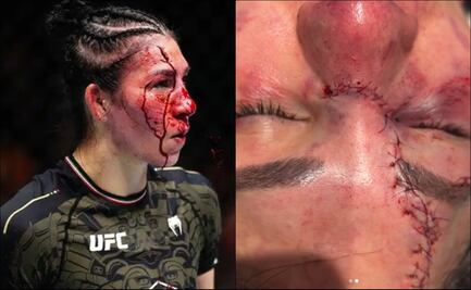 Médico de UFC aplaude fuerza de Irene Aldana tras hemorragia: “Qué superestrella tan valiente”