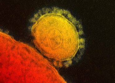Hidroxicloroquina y Remdesivir, posibles fármacos para combatir al coronavirus