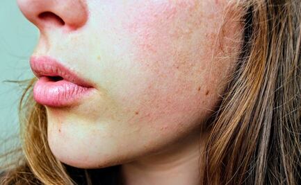 ¿Piel seca?: 7 errores que debes evitar en tu rutina facial