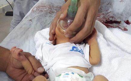 Decenas de hospitalizados por supuesto ataque químico en Siria