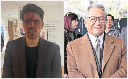 La violencia contra César D'Alessio y el susto por el Covid de Manzanero, entre lo más espectacular de la semana