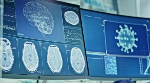 "Parece que perdí puntos de coeficiente intelectual": neuróloga investiga (y sufre) Covid de larga duración