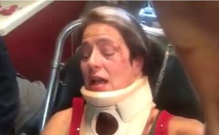 Actriz América Gabriel denuncia agresión en Parque México