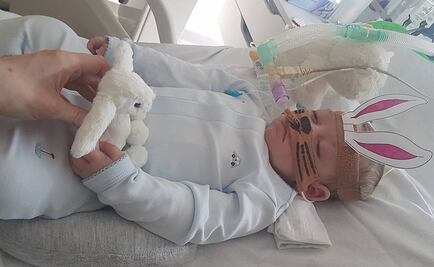 Charlie Gard, ¿morir con dignidad o luchar por una oportunidad?