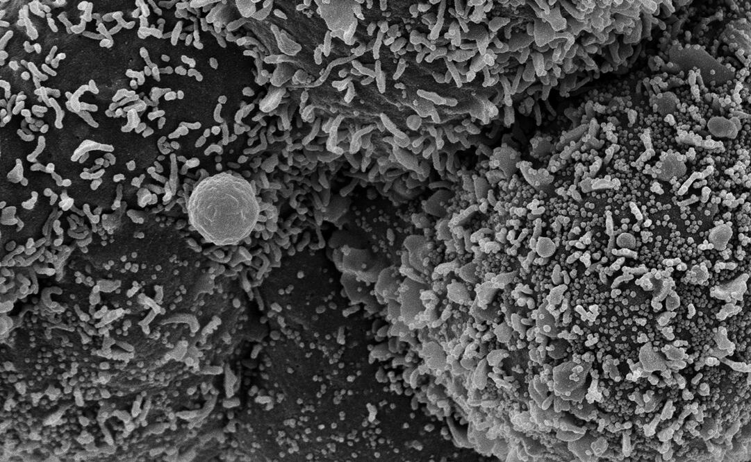 Foto: EFE/EPA/NIAID/NATIONAL INSTITUTES OF HEALTH 