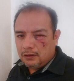 Regidor denuncia agresión de policías