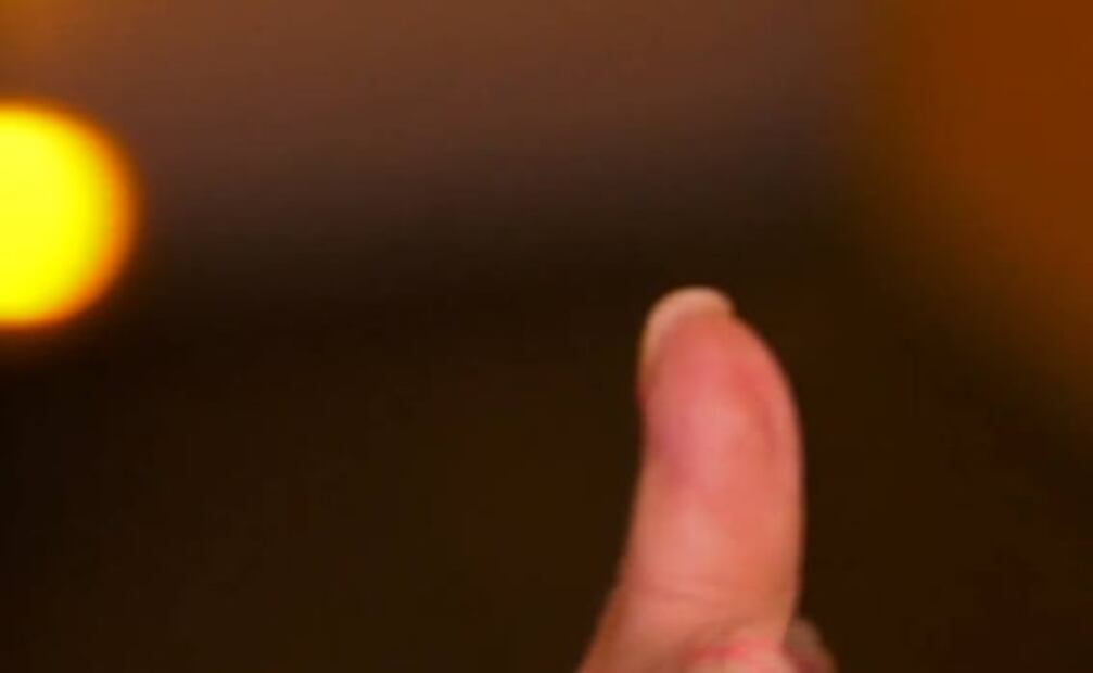 Grettell Valdez está libre de cáncer y muestra cómo quedó su dedo