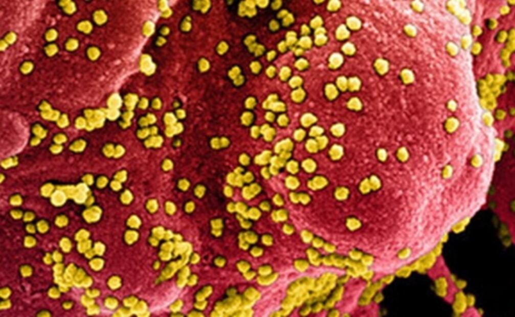 18 científicos creen posible que el coronavirus salió de un laboratorio