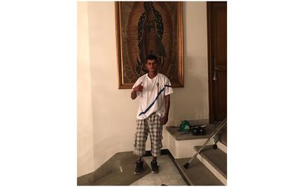 “El Capi” ya tiene pierna otra vez; empresario le regala prótesis