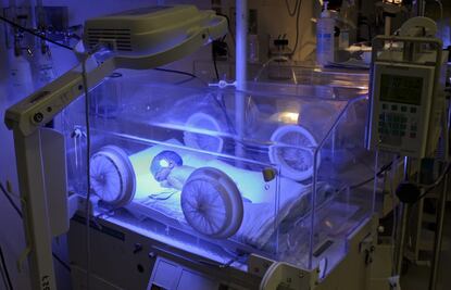 Nacimientos prematuros, cada vez más frecuentes: IMSS