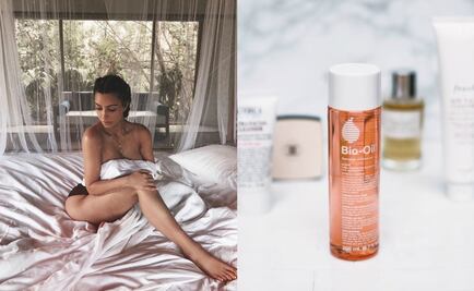 Kim Kardashian revela el remedio para combatir las estrías