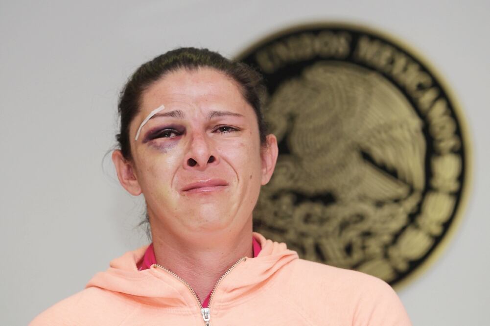 La ex atleta olímpica y actual senadora por el Partido del Trabajo Ana Gabriela Guevara fue víctima de una agresión el pasado domingo en la autopista México-Toluca cuando viajaba a bordo de una motocicleta  (ALEX CRUZ. EFE)