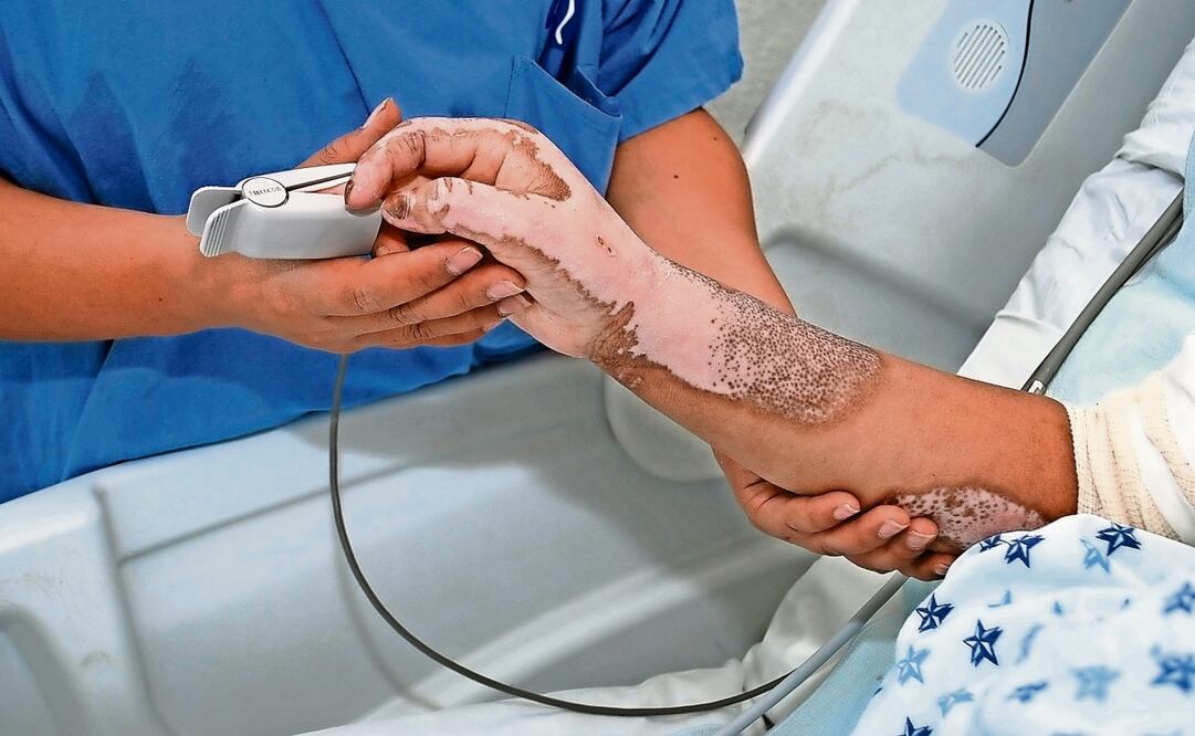 Cualquier persona que no goza de salud física debería poder decidir sobre su vida, señalaron especialistas. Foto: Archivo | El Universal