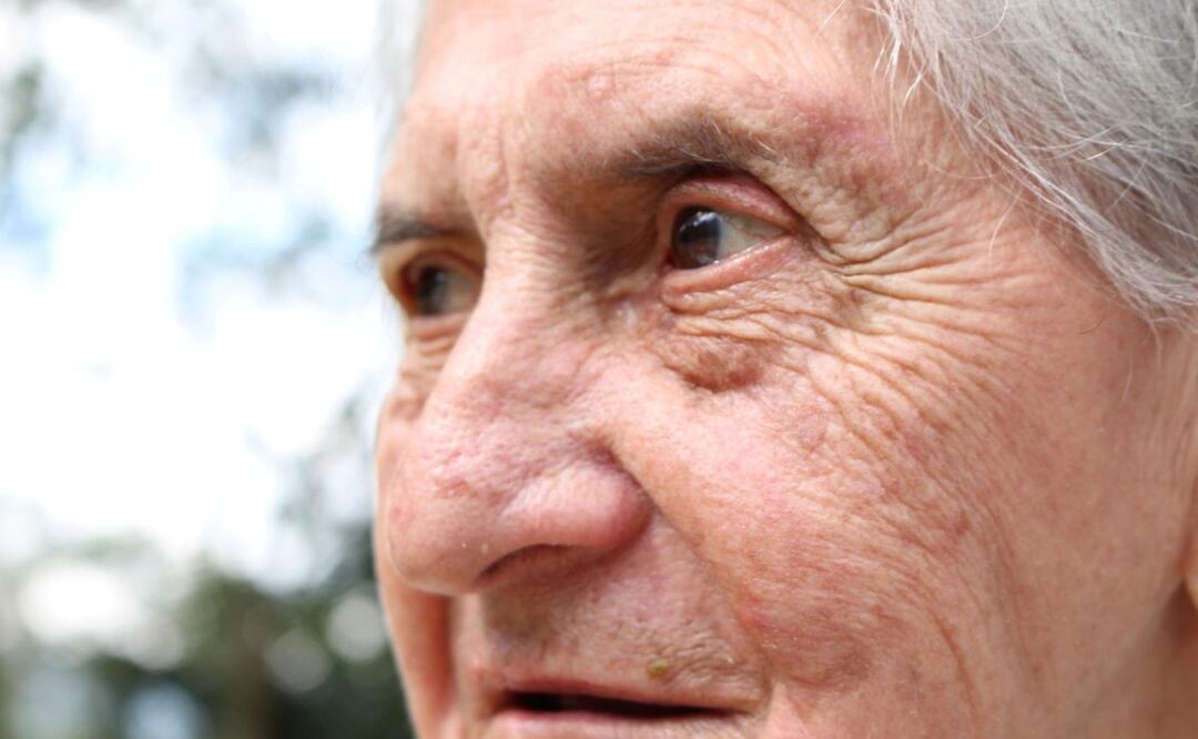 Alzheimer. Fuente: Pixabay