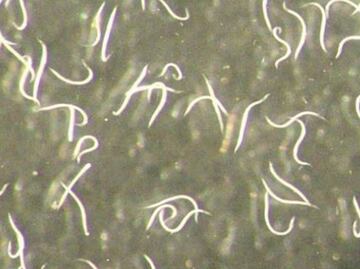 Descubren gusano nematodo invisible capaz de controlar plagas en cultivos cálidos