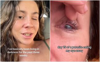 VIDEO: extranjera cuenta cómo fue que un parásito devoró la córnea de su ojo mientras vivía en México