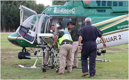 Solicitan donadores para bebé que sufrió quemaduras de tercer grado en incendio en Teoloyucan