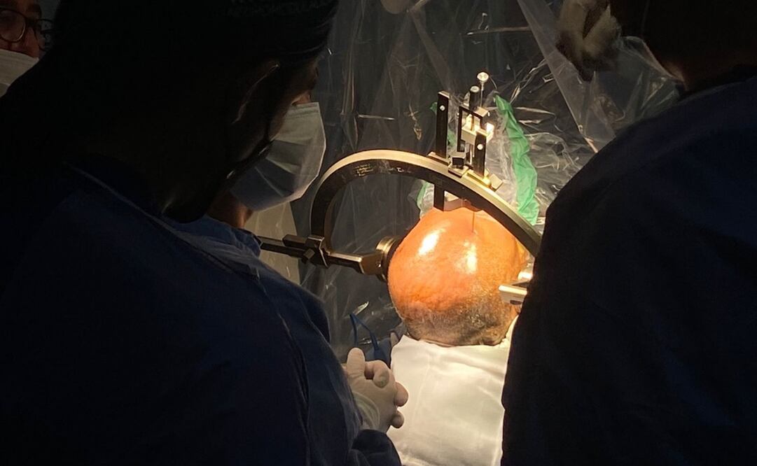 Antes de dicha intervención, don Carlos tenía una funcionalidad de apenas un 15%, y afectaba su movilidad, su lenguaje. Foto: Especial 