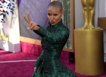 ¿Los tratamientos contra la alopecia son efectivos?