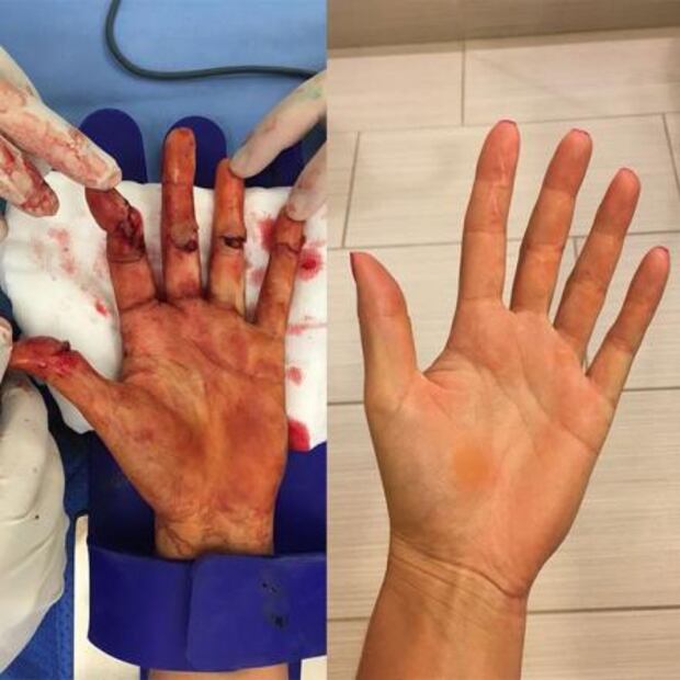 Kvitova regresa a la élite después del asalto que le destrozó la mano